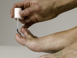 Nail fungus treatment