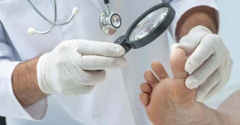 foot fungus treatment by a doctor