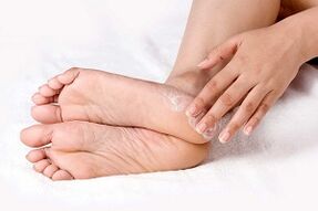 treating fungus on the skin of the feet with cream