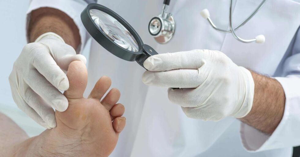 doctor examines feet for fungus
